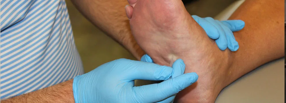 A therapist’s gloved hands dry needling the sole of a patient’s foot